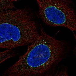 C2orf70 Antibody, Novus Biologicals 25 &mu;L, Unlabeled:Antibodies, Polyclonal